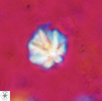 Olladiscoaster catinatus 29623