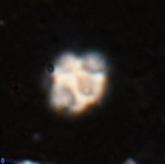 Olladiscoaster catinatus 29625