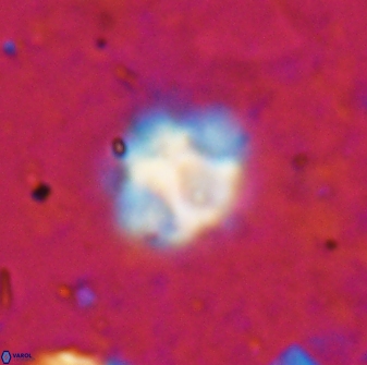 Olladiscoaster catinatus 29626