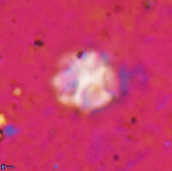 Olladiscoaster catinatus 29627