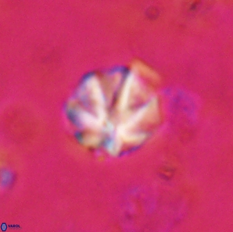 Olladiscoaster catinatus 29630