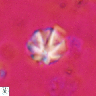 Olladiscoaster catinatus 29630