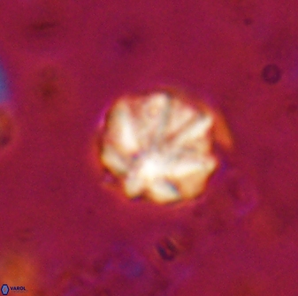 Olladiscoaster catinatus 29631