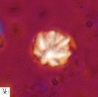 Olladiscoaster catinatus 29631