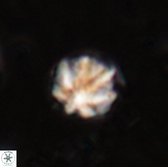 Olladiscoaster catinatus 29632