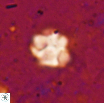 Olladiscoaster catinatus 29634