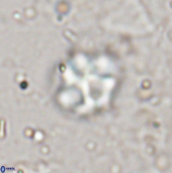 Olladiscoaster catinatus 29635