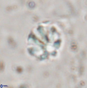 Olladiscoaster catinatus 29636