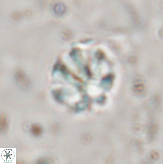 Olladiscoaster catinatus 29636