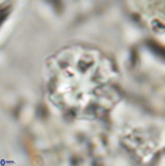 Olladiscoaster catinatus 30953