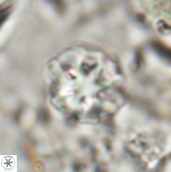 Olladiscoaster catinatus 30953