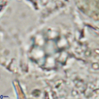 Olladiscoaster catinatus 30954