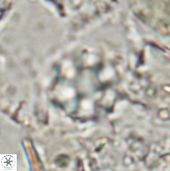 Olladiscoaster catinatus 30954