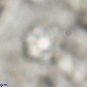 Olladiscoaster catinatus 30955