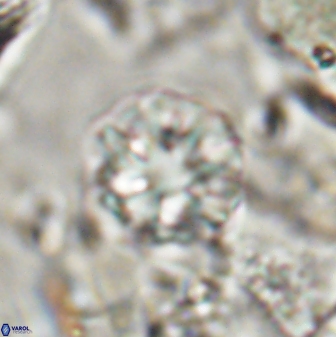 Olladiscoaster catinatus 30957