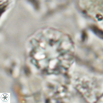 Olladiscoaster catinatus 30957