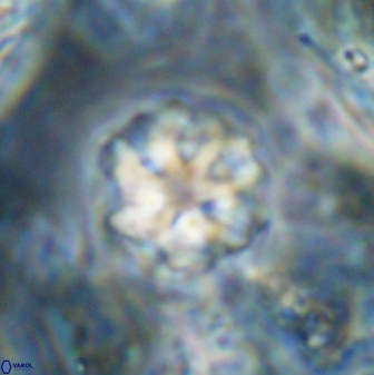 Olladiscoaster catinatus 30959