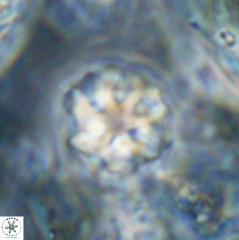 Olladiscoaster catinatus 30959
