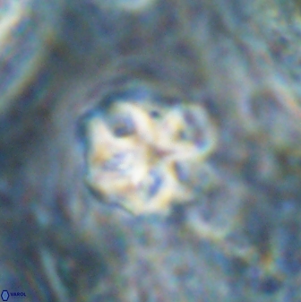 Olladiscoaster catinatus 30960