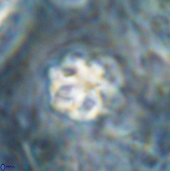 Olladiscoaster catinatus 30961
