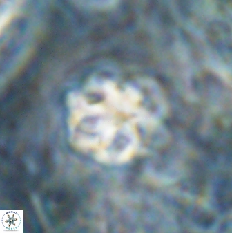 Olladiscoaster catinatus 30961