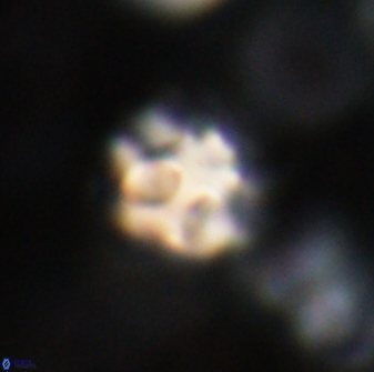 Olladiscoaster catinatus 30962