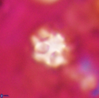 Olladiscoaster catinatus 30963