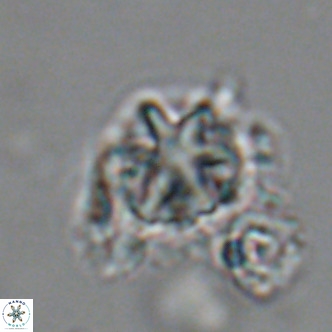 Olladiscoaster catinatus VR 18440