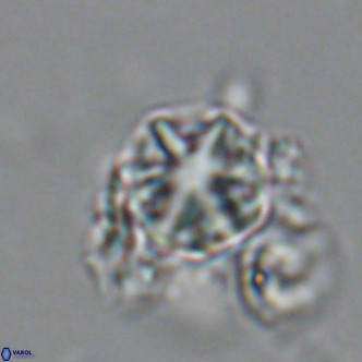Olladiscoaster catinatus VR 18441