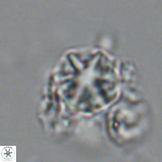 Olladiscoaster catinatus VR 18441