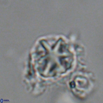 Olladiscoaster catinatus VR 18442