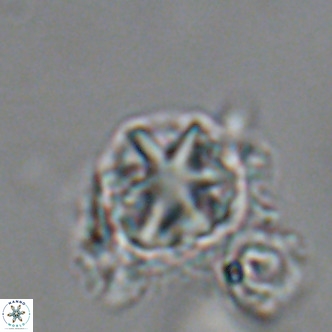 Olladiscoaster catinatus VR 18442