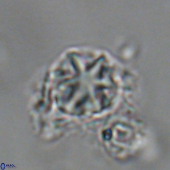 Olladiscoaster catinatus VR 18443