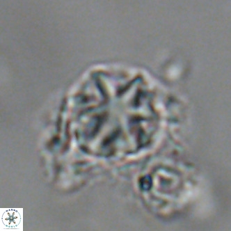 Olladiscoaster catinatus VR 18443