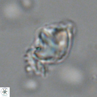 Olladiscoaster catinatus VR 18444