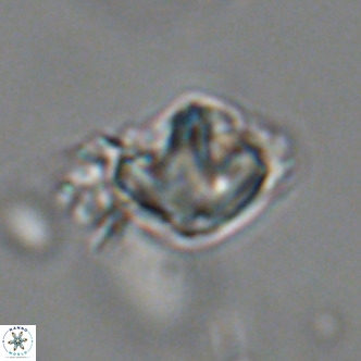 Olladiscoaster catinatus VR 18445