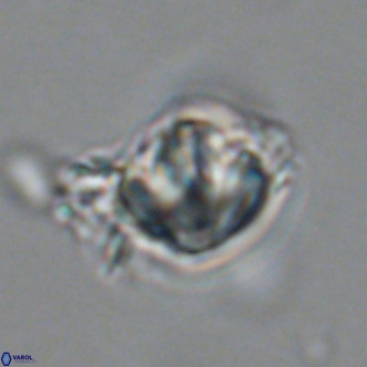 Olladiscoaster catinatus VR 18446