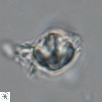 Olladiscoaster catinatus VR 18446