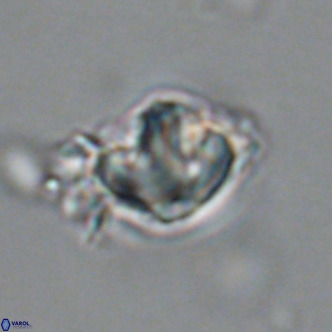 Olladiscoaster catinatus VR 18447