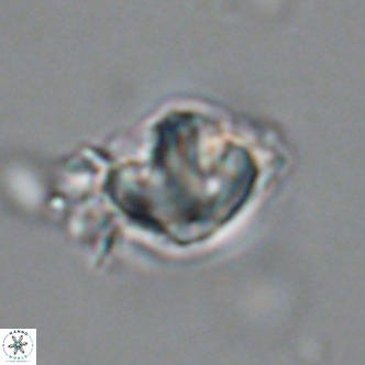 Olladiscoaster catinatus VR 18447