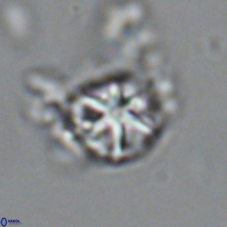 Olladiscoaster catinatus VR 18448