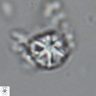 Olladiscoaster catinatus VR 18448