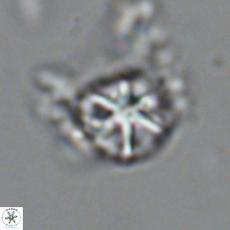 Olladiscoaster catinatus VR 18449