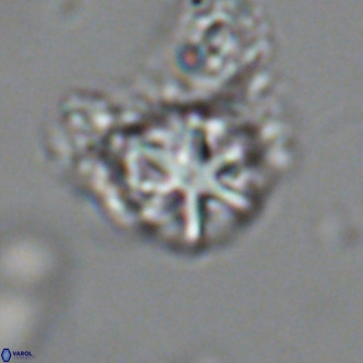 Olladiscoaster catinatus VR 18450