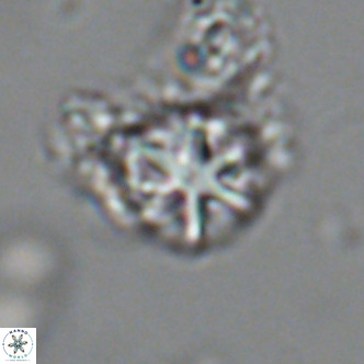 Olladiscoaster catinatus VR 18450