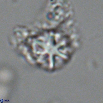 Olladiscoaster catinatus VR 18451