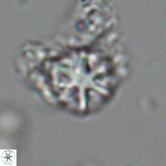 Olladiscoaster catinatus VR 18451