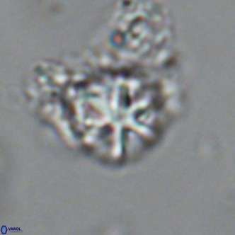 Olladiscoaster catinatus VR 18452
