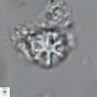 Olladiscoaster catinatus VR 18452