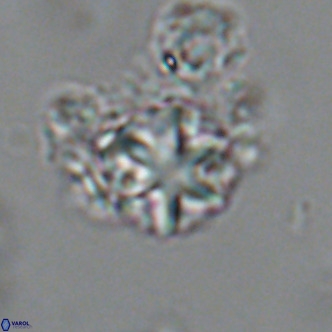 Olladiscoaster catinatus VR 18453